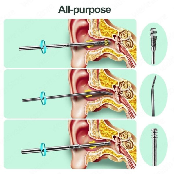 Nettoyeur de cérumen outil d'élimination du cérumen, cure-oreille, artefact de creusement, nettoyage des oreilles, dissolvant d'oreilles pour nettoyer votre Kit Gadgets – Image 3